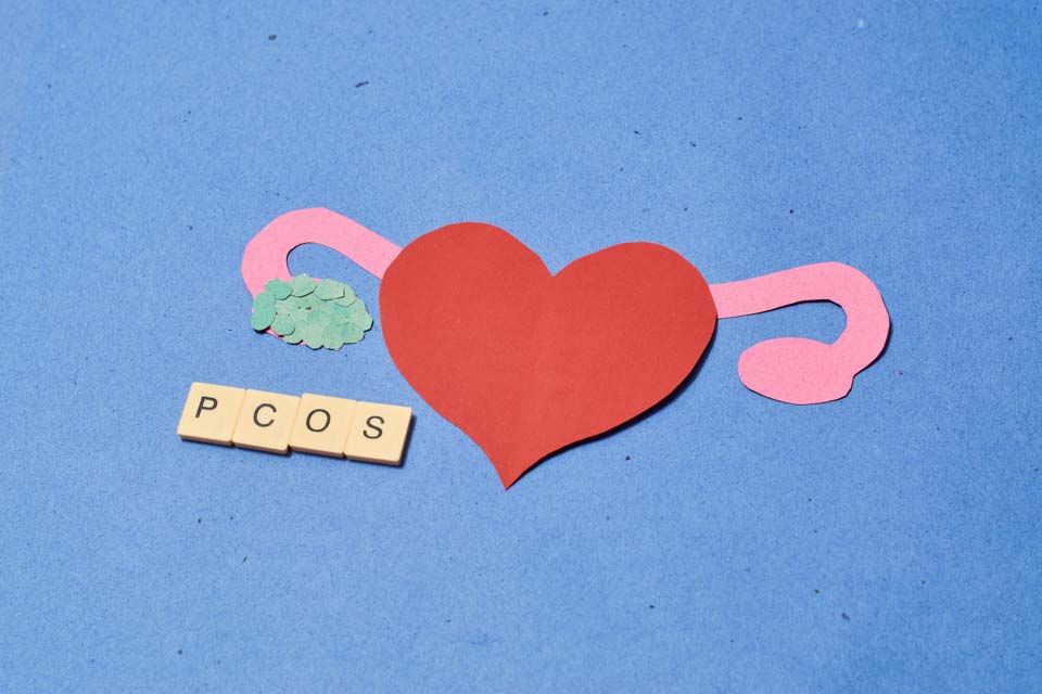 Understanding Polycystic Ovary Syndrome